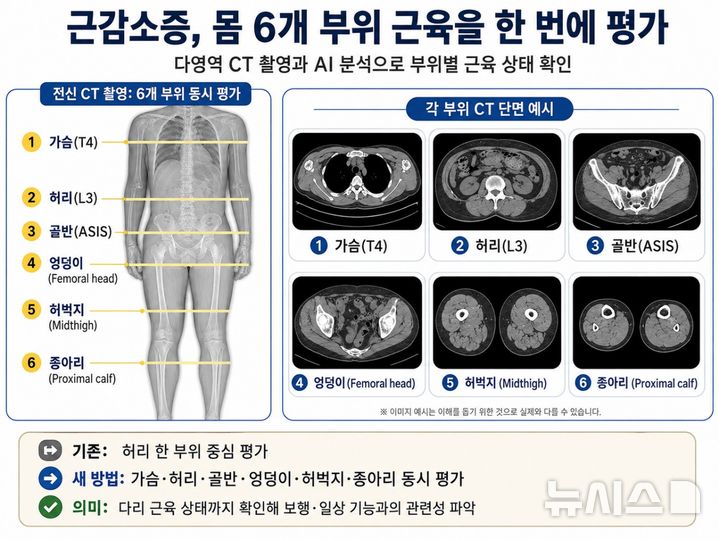 [서울=뉴시스] 박중현 교수 연구팀이 전신 CT 촬영과 AI 분석을 바탕으로 한 근감소증 평가법을 개발했다. (사진= 강남세브란스병원 제공)