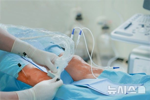 [서울=뉴시스] 환자의 무릎에 고주파 치료술을 시행하고 있다. (사진= 연세사랑병원 제공)