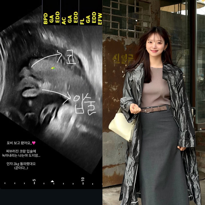 [서울=뉴시스] 인플루언서 김지영 (사진= 김지영 SNS 캡쳐) 2026.06.05. photo@newsis.com *재판매 및 DB 금지
