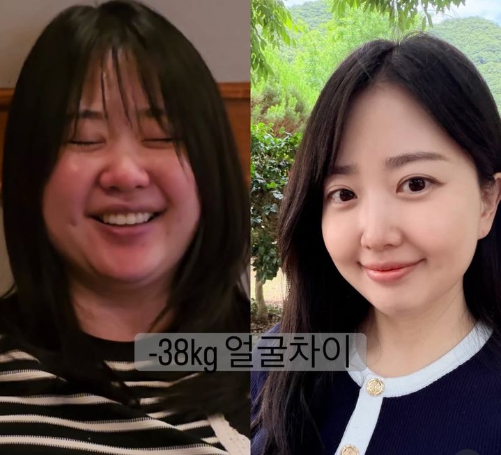 [서울=뉴시스]김다예 다이어트 전 후 모습. (사진출처:김다예 SNS) 2026.06.25 *재판매 및 DB 금지