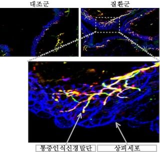 [서울=뉴시스] 반복적인 염증 이후 방광 상피세포(파란색)를 따라 통증 인식 신경(노란색)이 새롭게 증식하며 조직 안으로 침투하는 모습. (사진=고려대 제공) 2026.06.30. photo@newsis.com *재판매 및 DB 금지