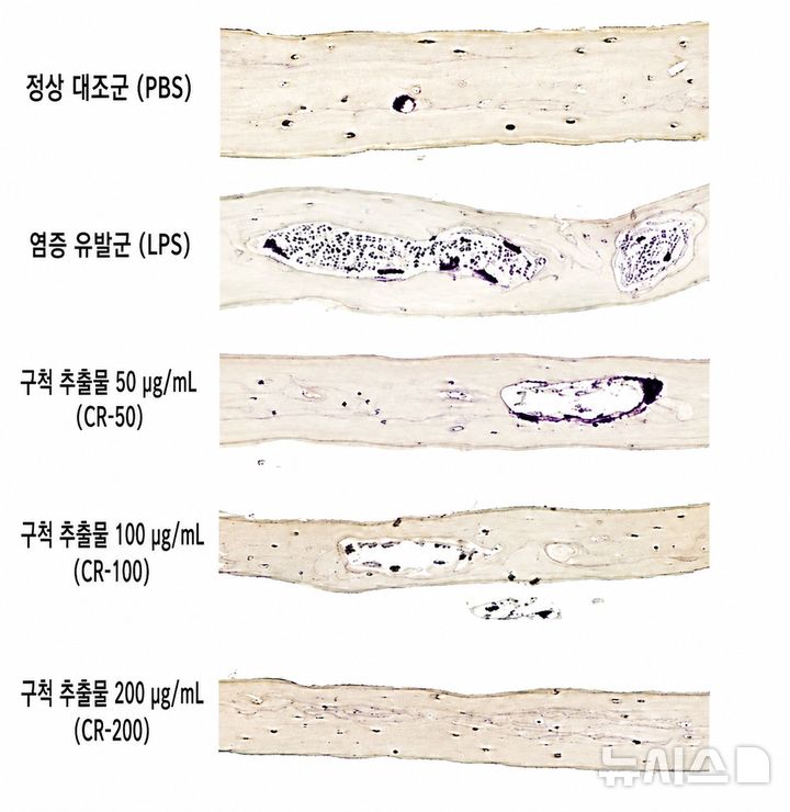 [서울=뉴시스] ] 실험쥐 머리뼈 조직 내 골 염증 유발군(LPS)에서 급증했던 파골세포(보라색)와 골미란 현상이 구척(CR) 추출물 투여 농도가 높아질수록 현저히 감소했으며, 최고 농도(CR-200)에서는 정상 대조군(PBS)과 유사한 수준으로 회복됐다. (사진= 자생한방병원 제공)