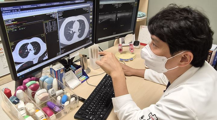 "AI로 폐암 조기 발견" 울산병원, 루카스 플러스 도입
