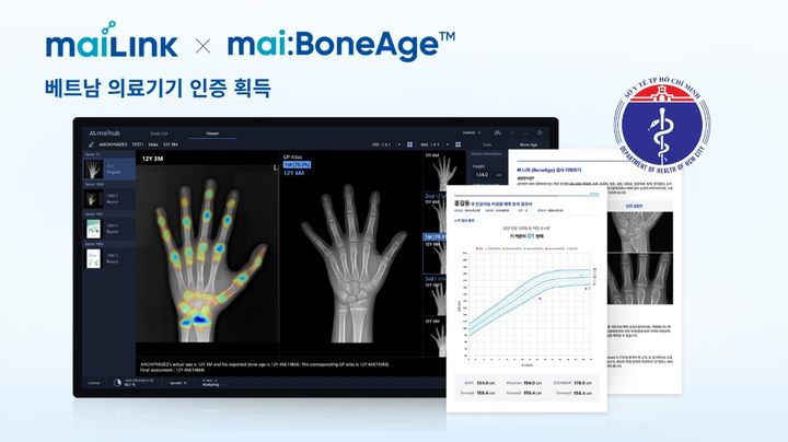 [서울=뉴시스] 마이허브는 자사의 의료 AI 플랫폼 ‘마이링크’와 골연령 분석 AI ‘마이본에이지’의 베트남 의료기기 인증을 확보했다고 7일 밝혔다. (사진=마이허브 제공) 2026.07.07. photo@newsis.com *재판매 및 DB 금지
