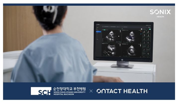 [서울=뉴시스] 온택트헬스는 순천향대 부천병원에 인공지능(AI) 기반 심장초음파 분석 솔루션 '소닉스헬스(Sonix Health)'를 공급했다고 16일 밝혔다. (사진=온택트헬스 제공) 2026.07.16. photo@newsis.com *재판매 및 DB 금지