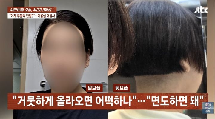 [서울=뉴시스] 미용사의 권유로 투블럭 시술을 받았으나 뒷머리가 과도하게 밀려 일상생활이 불가능해진 피해자의 모습이다. (사진 출처=JTBC '사건반장' 캡)