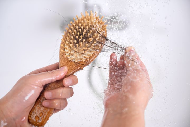 "기존 치료제와 달라"...새 탈모약 찾는 K-제약바이오 - 뉴스 썸네일 이미지