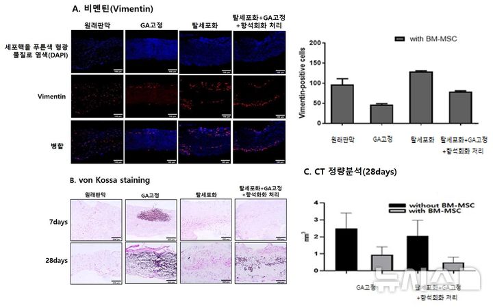 [서울=뉴시스] 생체 내 실험: 탈세포화 후 글루타르알데하이드(GA) 고정 및 항석회화 처리를 거쳐 재세포화된 이식편이 (A) 조직분석에서 Vimentin(빨간색) 발현 증가 (B) von Kossa 염색에서 석회화 분포(검은색) 감소 (C) CT 정량 분석 시 칼슘 침착 유의하게 감소. (사진= 서울대학교병원 제공)