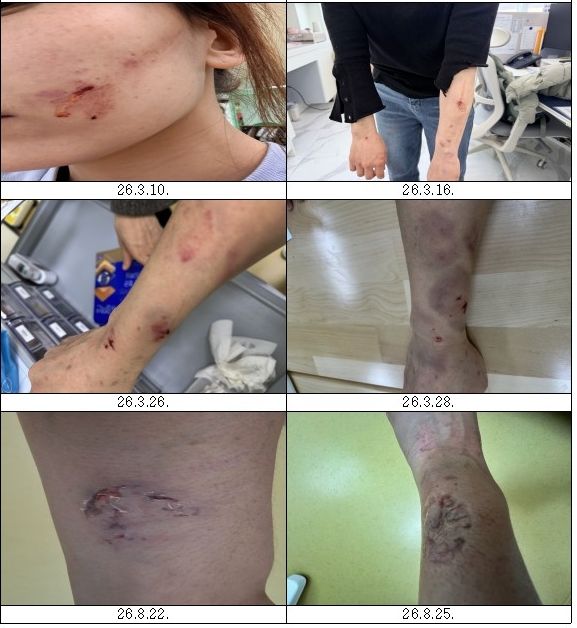 [세종=뉴시스] 송승화 기자 = 전교조 세종지부가 공개한 교사 피해 사례.(사진=전교조 세종지부).2026.07.31. photo@newsis.com. *재판매 및 DB 금지