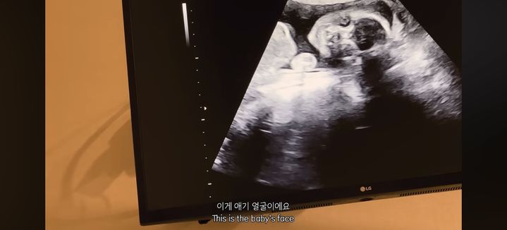 [서울=뉴시스] 안나. (사진 = 유튜브 캡처) 2026.08.13. photo@newsis.com *재판매 및 DB 금지