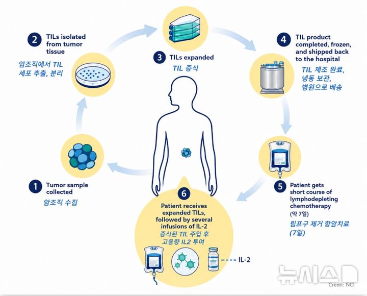 [서울=뉴시스] TIL 임상 치료 과정. (사진= 분당차병원 제공)
