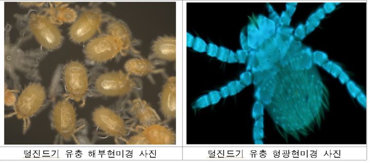 [세종=뉴시스]털진드기 유충 현미경 사진. (사진=질병관리청 제공) 2026.08.26. photo@newsis.com *재판매 및 DB 금지