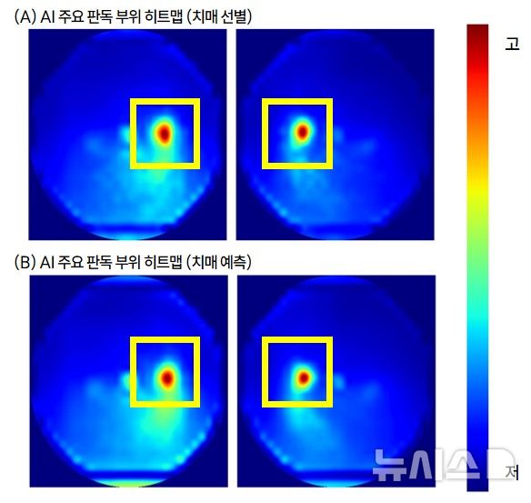 [서울=뉴시스] 인공지능이 안저 사진의 어느 부위를 보고 판단했는지 보여주는 히트맵. (사진= 서울대병원 제공)