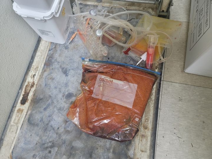 [서울=뉴시스] 지퍼팩에 담긴 폐지방(조직물류폐기물을 일반의료폐기물에 섞어 보관하다가 적발됨). (사진=서울시 제공) 2026.09.03. photo@newsis.com *재판매 및 DB 금지