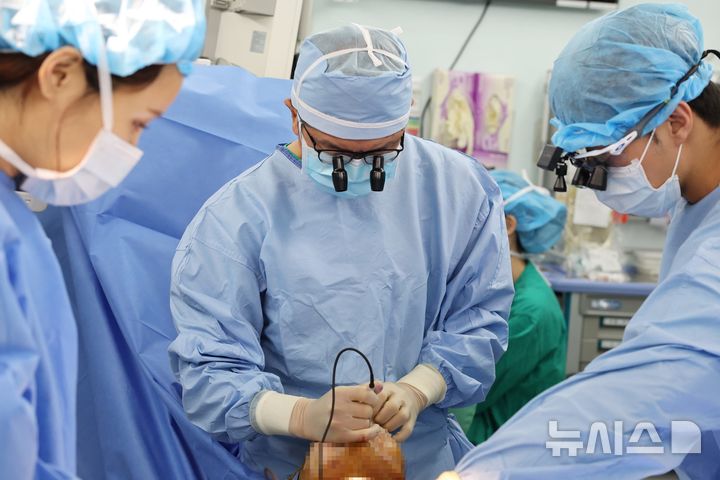 [서울=뉴시스] 최종우 서울아산병원 성형외과 교수(가운데)가 9일 두경부암 절제 수술을 받은 환자에게 미세유리피판을 이용한 재건수술을 시행하고 있다. (사진= 서울아산병원 제공)