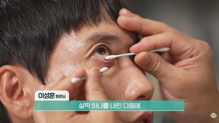 [서울=뉴시스]안과에서 기름샘을 짜내고 집에서 온찜질을 반족하면 안구건조증 증상이 개선될 수 있다는 전문의의 조언이 나왔다.(사진=유튜브 '닥터딩요' 캡처)2026.09.20.