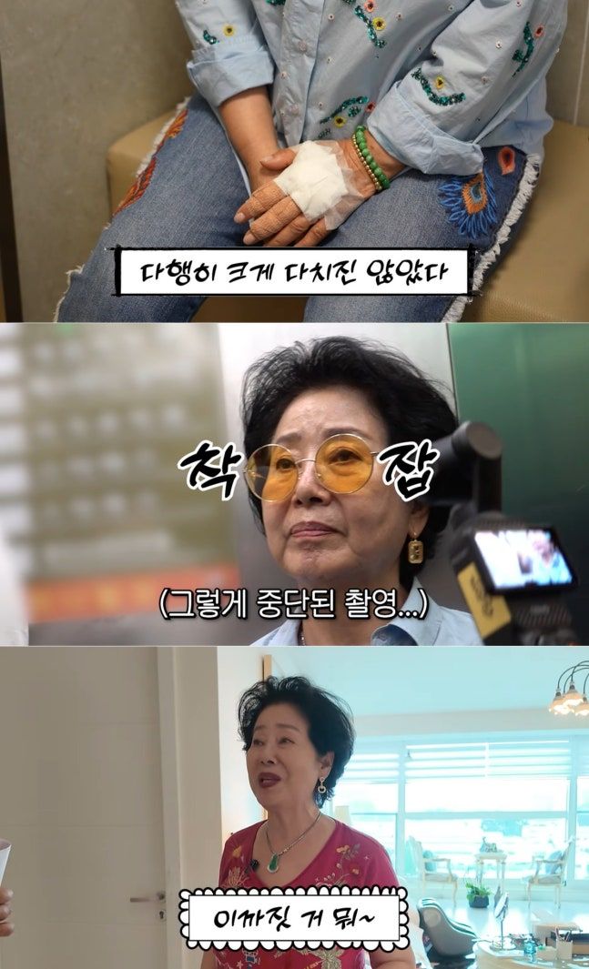 선우용여 손등 화상에 촬영 중단 "잘한다고 자랑하다가"