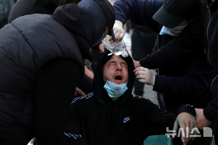 최루가스에 괴로워하는 알바니아 시위 참가자