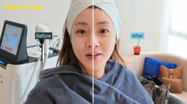 강소라, 촬영 전 레이저 시술 "돈을 안 쓸 수가 없다"