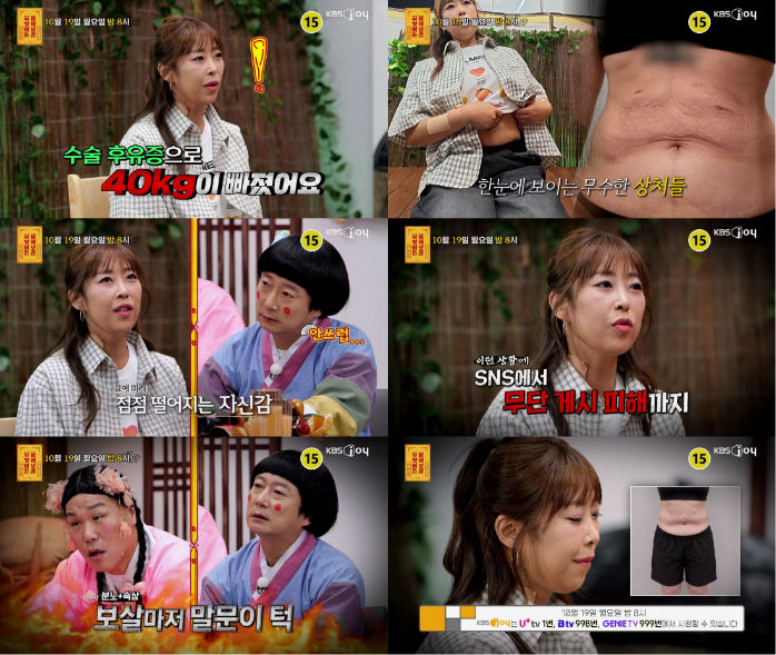 [서울=뉴시스] 19일 오후 8시 방송되는 KBS Joy 예능물 '무엇이든 물어보살' 386회에는 수술 후 급격한 체중 변화로 자신감을 잃었다는 여성이 출연한다. (사진=KBS Joy) 2026.10.19. photo@newsis.com *재판매 및 DB 금지