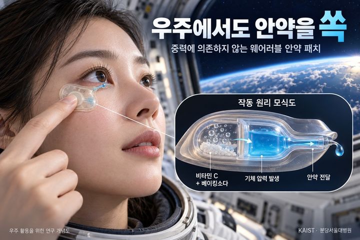 [대전=뉴시스] KAIST 바이오및뇌공학과 정기훈 교수연구팀이 비타민 C와 베이킹소다의 화학반응을 이용해 중력 없는 환경에서도 안약을 눈에 전달하는 웨어러블 패치를 개발했다. 사진은 연구 요약도.(사진=KAIST 제공) *재판매 및 DB 금지