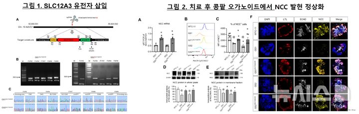[서울=뉴시스] 기틀만 유전자 치료제. (사진= 서울성모병원 제공)