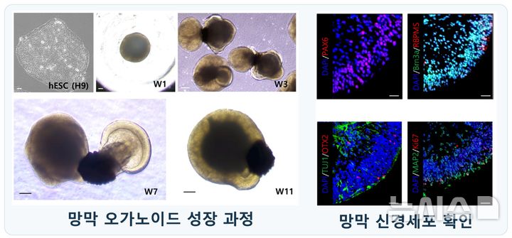 [서울=뉴시스] 오가노이드사이언스는 회사의 RGB 연구소와 차병원 안과 유혜린 교수팀이 인간 망막을 재현한 '망막 오가노이드'를 활용해 망막 손상 및 치료 후보물질의 효과를 평가한 공동연구 결과를 국제학술지인 'Frontiers in Cell and Developmental Biology'에 발표했다고 27일 밝혔다. (사진=오가노이드사이언스 제공) 2026.10.27. photo@newsis.com