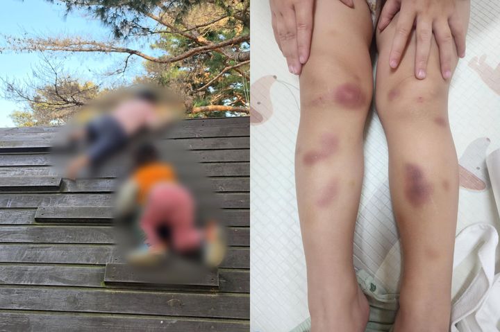 [서울=뉴시스] 아동학대 의심 신고로 33개월 아이와 일주일째 분리된 부모가 억울함을 호소했다. (사진출처=보배드림 캡처) *재판매 및 DB 금지